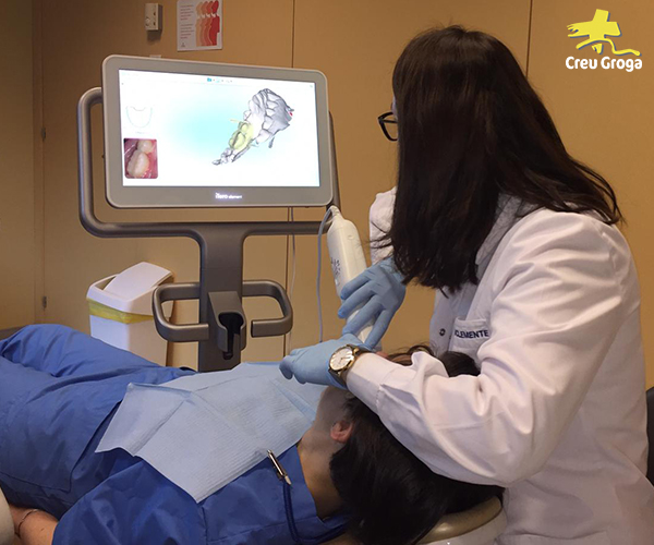 Escaner ITERO clinica dental Creu Groga